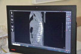 Tatvan’da Başarılı İki Ameliyata İmza Atıldı